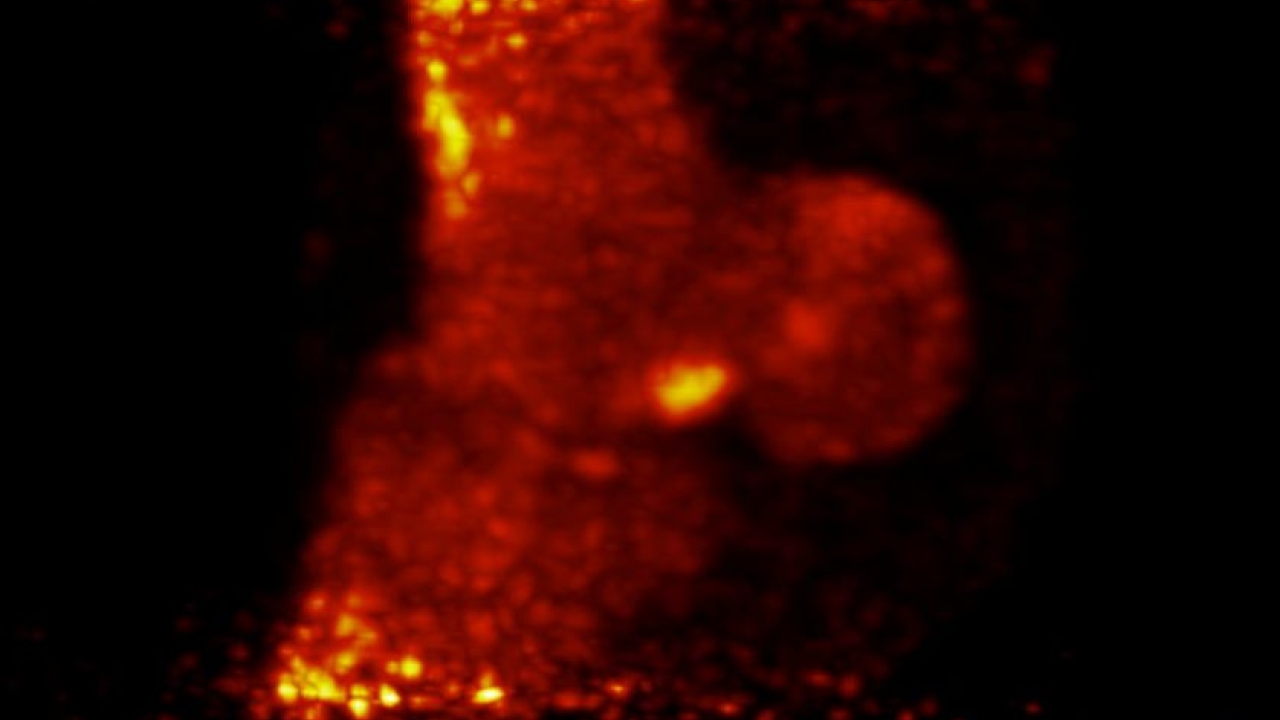 Credit: Paulick Report Pet scan