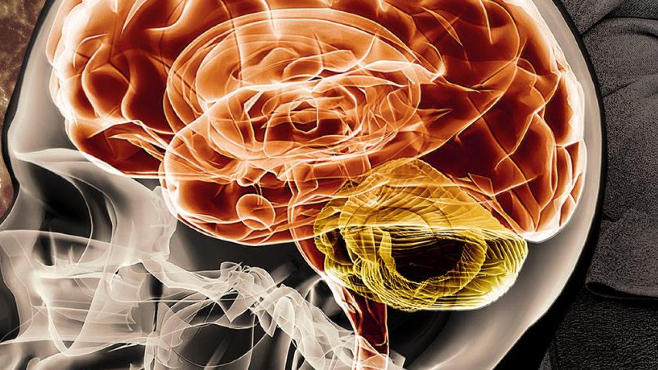 Image of a brain