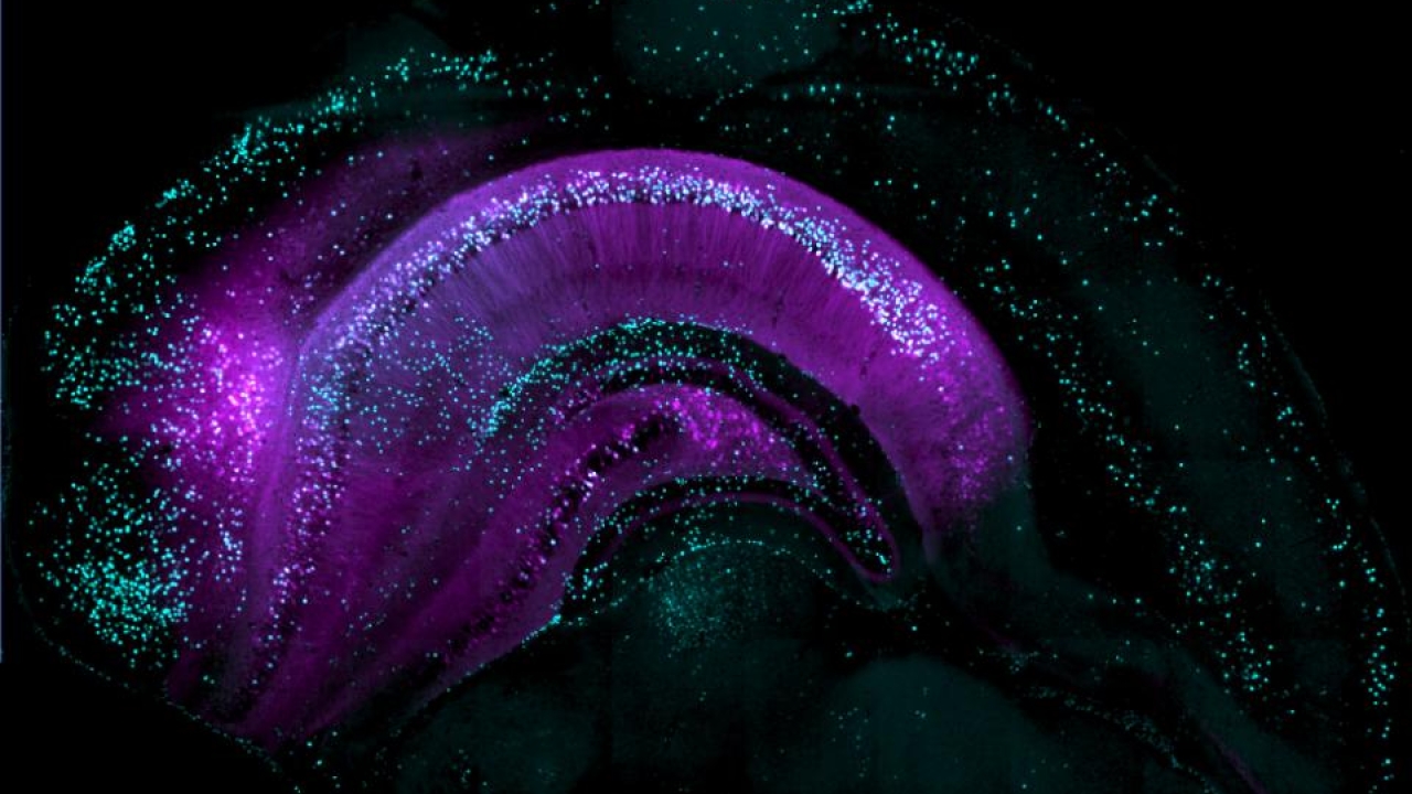Image of brain