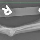 Radiograph of Ethel's leg after plate removal.